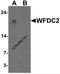 WAP Four-Disulfide Core Domain 2 antibody, 7459, ProSci, Western Blot image 