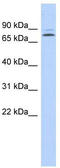 Kelch Like Family Member 14 antibody, TA339243, Origene, Western Blot image 