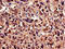 Ubiquilin 2 antibody, LS-C675091, Lifespan Biosciences, Immunocytochemistry image 