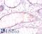 Tubulin Beta 3 Class III antibody, LS-C317462, Lifespan Biosciences, Immunohistochemistry paraffin image 