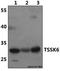 Testis-specific serine/threonine-protein kinase 6 antibody, GTX66809, GeneTex, Western Blot image 