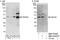 Zinc Finger Protein 444 antibody, NBP1-78191, Novus Biologicals, Western Blot image 