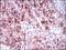 Fms Related Tyrosine Kinase 3 antibody, NBP2-37363, Novus Biologicals, Immunohistochemistry paraffin image 