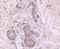 Peptidylprolyl Isomerase A antibody, A01308-1, Boster Biological Technology, Immunohistochemistry paraffin image 