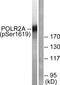 RNA Polymerase II Subunit A antibody, P30431, Boster Biological Technology, Western Blot image 