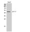 Adrenoceptor Beta 2 antibody, STJ91725, St John