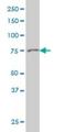 Gelsolin antibody, H00002934-M01, Novus Biologicals, Western Blot image 