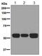 Cytochrome B-245 Beta Chain antibody, ab129068, Abcam, Western Blot image 