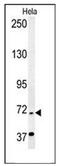 ERCC Excision Repair 6 Like 2 antibody, AP53561PU-N, Origene, Western Blot image 