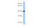 GA Binding Protein Transcription Factor Subunit Beta 1 antibody, 26-562, ProSci, Western Blot image 