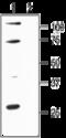 Small conductance calcium-activated potassium channel protein 1 antibody, GTX16649, GeneTex, Western Blot image 