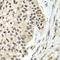 Replication Factor C Subunit 5 antibody, A08976, Boster Biological Technology, Immunohistochemistry frozen image 