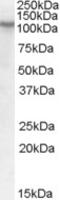 Dachshund Family Transcription Factor 2 antibody, 46-650, ProSci, Western Blot image 