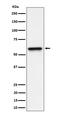 Regulator Of G Protein Signaling 6 antibody, M05753, Boster Biological Technology, Western Blot image 