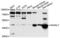 Alpha 1,4-Galactosyltransferase (P Blood Group) antibody, LS-C410351, Lifespan Biosciences, Western Blot image 