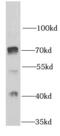 Protein Arginine Methyltransferase 5 antibody, FNab06791, FineTest, Western Blot image 