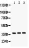 Interleukin 3 antibody, LS-C357459, Lifespan Biosciences, Western Blot image 