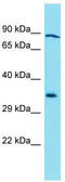 Galactosidase Beta 1 Like 3 antibody, TA337320, Origene, Western Blot image 