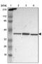 PHD Finger Protein 6 antibody, PA5-51501, Invitrogen Antibodies, Western Blot image 