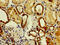 N-Acylsphingosine Amidohydrolase 2 antibody, CSB-PA002170EA01HU, Cusabio, Immunohistochemistry paraffin image 