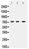 ATP Binding Cassette Subfamily G Member 5 antibody, PA5-78702, Invitrogen Antibodies, Western Blot image 