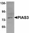 Protein Inhibitor Of Activated STAT 3 antibody, orb94380, Biorbyt, Western Blot image 