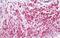 Caldesmon 1 antibody, MBS247507, MyBioSource, Immunohistochemistry paraffin image 
