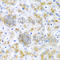 Wnt Family Member 2 antibody, A5864, ABclonal Technology, Immunohistochemistry paraffin image 