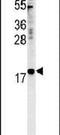 Nucleoplasmin-3 antibody, PA5-25254, Invitrogen Antibodies, Western Blot image 