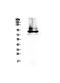 Cf2 antibody, PA5-79226, Invitrogen Antibodies, Western Blot image 