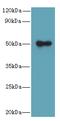 Gasdermin B antibody, A59314-100, Epigentek, Western Blot image 