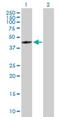 Farnesyl-Diphosphate Farnesyltransferase 1 antibody, H00002222-B01P, Novus Biologicals, Western Blot image 