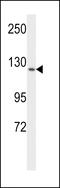 Fms Related Tyrosine Kinase 1 antibody, MBS9209357, MyBioSource, Western Blot image 