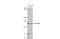 Rho Associated Coiled-Coil Containing Protein Kinase 1 antibody, GTX113266, GeneTex, Western Blot image 