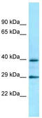 Adrenoceptor Alpha 2C antibody, TA342799, Origene, Western Blot image 