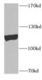 Polo Like Kinase 4 antibody, FNab06550, FineTest, Western Blot image 