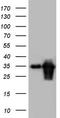 Transforming Acidic Coiled-Coil Containing Protein 2 antibody, TA804400, Origene, Western Blot image 