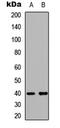 Lemur Tyrosine Kinase 3 antibody, LS-C358796, Lifespan Biosciences, Western Blot image 