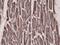 Acetyl-CoA Carboxylase Alpha antibody, GTX33608, GeneTex, Immunohistochemistry paraffin image 