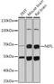 Neurofilament Light antibody, GTX32419, GeneTex, Western Blot image 