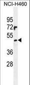 PRAME Family Member 6 antibody, LS-C162114, Lifespan Biosciences, Western Blot image 