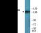 Nitric Oxide Synthase 3 antibody, EKC2397, Boster Biological Technology, Western Blot image 