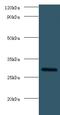 Fibroblast Growth Factor 23 antibody, LS-C369619, Lifespan Biosciences, Western Blot image 