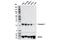 Transgelin 2 antibody, 62567S, Cell Signaling Technology, Western Blot image 