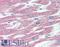TNF Receptor Superfamily Member 11a antibody, LS-B2076, Lifespan Biosciences, Immunohistochemistry frozen image 