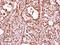 THO Complex 1 antibody, NBP2-16822, Novus Biologicals, Immunohistochemistry frozen image 