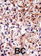 Cell Cycle Associated Protein 1 antibody, abx031601, Abbexa, Immunohistochemistry paraffin image 