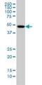 Iroquois Homeobox 5 antibody, H00010265-M10, Novus Biologicals, Western Blot image 