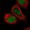 TOPBP1 Interacting Checkpoint And Replication Regulator antibody, NBP2-58491, Novus Biologicals, Immunofluorescence image 