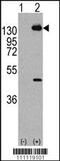 Platelet Derived Growth Factor Receptor Alpha antibody, 63-119, ProSci, Western Blot image 